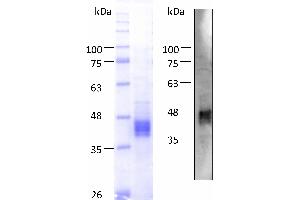 Western Blotting (WB) image for Proline Rich, Lacrimal 1 (PROL1) (AA 22-248) protein (His tag) (ABIN3086623) (PROL1 Protein (AA 22-248) (His tag))