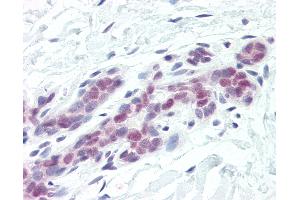 Anti-DFFA / ICAD antibody IHC of human breast.