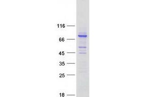 Western Blotting (WB) image for Coiled-Coil Domain Containing 138 (CCDC138) protein (Myc-DYKDDDDK Tag) (ABIN2713290)