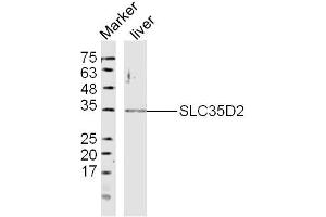 Mouse Liver lysates probed with SLC35D2 Polyclonal Antibody, Unconjugated  at 1:300 dilution and 4˚C overnight incubation. (Solute Carrier Family 35 (UDP-GlcNAc/UDP-Glucose Transporter), Member D2 (SLC35D2) (AA 251-326) Antikörper)
