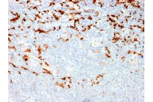 Formalin-fixed, paraffin-embedded human Lymph Node in Colon stained with CD163 Mouse Monoclonal Antibody (M130/2164). (CD163 Antikörper  (AA 43-196))