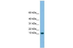 WB Suggested Anti-C13orf30 Antibody Titration: 0. (C13orf30 Antikörper  (N-Term))