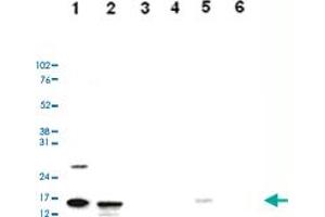 Western Blot analysis of (1) 25 ug whole cell extracts of Hela cells, (2) 15 ug histone extracts of Hela cells, (3) 1 ug of recombinant histone H2A, (4) 1 ug of recombinant histone H2B, (5) 1 ug of recombinant histone H3, (6) 1 ug of recombinant histone H4. (HIST1H3A Antikörper  (acLys36))