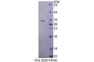 SDS-PAGE analysis of Rat USP1 Protein. (USP1 Protein)