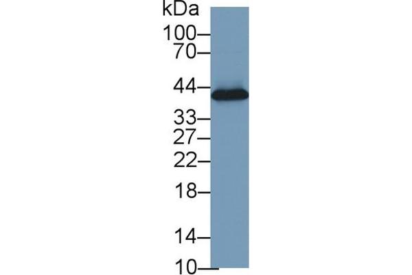 Haptoglobin anticorps  (AA 123-307)