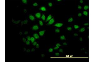 Immunofluorescence of monoclonal antibody to SAV1 on HeLa cell. (SAV1 Antikörper  (AA 300-383))