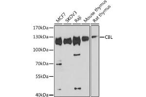 Western blot analysis of extracts of various cell lines, using CBL antibody (ABIN6131302, ABIN6138002, ABIN6138004 and ABIN6213970) at 1:1000 dilution. (CBL Antikörper  (AA 637-906))