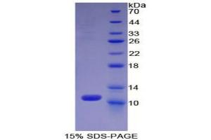 SDS-PAGE (SDS) image for Chemokine (C-C Motif) Ligand 13 (CCL13) (AA 17-98) protein (His tag) (ABIN1880091)