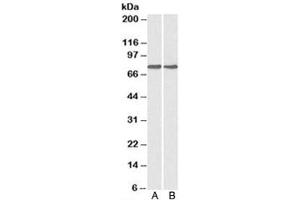 Western blot testing of A) HepG2 and B) MCF7 cell lysate with GRP78 antibody at 0. (GRP78 Antikörper)