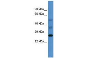 Image no. 1 for anti-COMM Domain Containing 2 (COMMD2) (AA 72-121) antibody (ABIN6746475) (COMMD2 Antikörper  (AA 72-121))