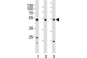 Western blot analysis of lysate from (1) HepG2, (2) HT-29, and (3) SW620 cell line using FOXA2 antibody at 1:1000. (FOXA2 Antikörper  (C-Term))
