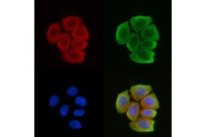 ABIN6259090 and ABIN6274229 staining Hela cells(30 min of UV treatment) by IF/ICC. (KAP1 Antikörper  (Internal Region))