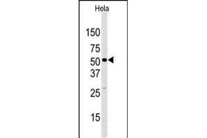 Western blot analysis of anti-JMJD2D (C-term) Pab in Hela cell line lysate. (JMJD2D Antikörper  (C-Term))
