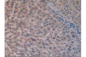 IHC-P analysis of Human Liver Tissue, with DAB staining. (CS Antikörper  (AA 103-394))