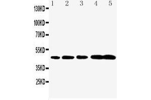 Anti-Caspase-1(P20) antibody, Western blotting Lane 1: Rat Brain Tissue Lysate Lane 2: Rat Spleen Tissue Lysate Lane 3: Mouse Brain Tissue Lysate Lane 4: Mouse Spleen Tissue Lysate Lane 5: Mouse Testis Tissue Lysate (Caspase 1 Antikörper  (N-Term))