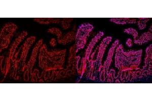 IF analysis of HMGB2 using anti-HMGB2 antibody (ABIN4886620).