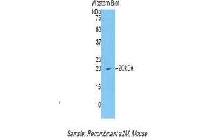 Western blot analysis of recombinant Mouse a2M. (alpha 2 Macroglobulin Antikörper  (AA 1053-1214))