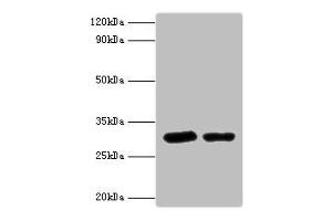 Western blot All lanes: Syntaxin-6 antibody at 2 μg/mL Lane 1: Mouse brain tissue Lane 2: 293T whole cell lysaye Secondary Goat polyclonal to rabbit IgG at 1/10000 dilution Predicted band size: 29 kDa Observed band size: 29 kDa (Syntaxin 6 Antikörper  (AA 4-231))