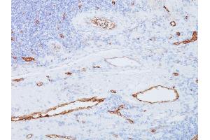 Formalin-fixed, paraffin-embedded human Tonsil stained with vWF Mouse Monoclonal Antibody (3E2D10). (VWF Antikörper  (AA 845-949))