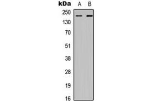 Western blot analysis of CHD2 expression in HEK293T (A), A549 (B) whole cell lysates.