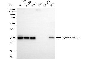 Western blotting analysis using thymidine kinase 1 antibody (ABIN7800551).