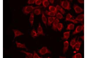 ABIN6266879 staining HepG2 by IF/ICC. (MAGEA1 Antikörper  (C-Term))