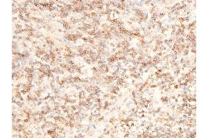 ABIN6267236 at 1/100 staining human appendiceal tissue sections by IHC-P. (MAP3K7 Antikörper  (pThr187))