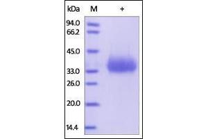 SDS-PAGE (SDS) image for CD2 (CD2) (AA 25-209) (Active) protein (His tag) (ABIN2180720)