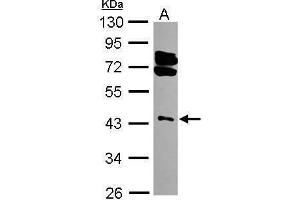 WB Image Sample (30 ug of whole cell lysate) A: 293T 10% SDS PAGE antibody diluted at 1:3000 (RING1 Antikörper)