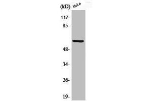 Western Blot analysis of HeLa cells using Phospho-Akt1 (S246) Polyclonal Antibody (AKT1 Antikörper  (pSer246))