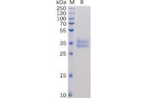Human IL2RB Protein, His Tag on SDS-PAGE under reducing condition.