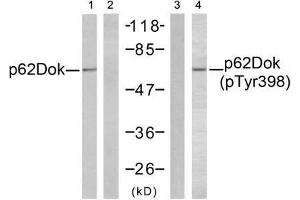 Western blot analysis of extracts from K562 cells, using p62Dok (Ab-398) antibody (E021269, Lane 1 and 2) and p62Dok (phospho-Tyr398) antibody (E011277, Lane 3 and 4). (DOK1 Antikörper  (pTyr398))