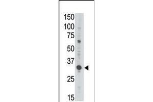 Antibody is used in Western blot to detect MAGEA3 in Jurkat lysate. (MAGEA3 Antikörper  (C-Term))
