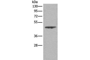 Western blot analysis of A431 cell lysate using ASS1 Polyclonal Antibody at dilution of 1:350 (ASS1 Antikörper)