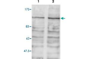 Western blot was performed on whole cell lysates from mouse fibroblasts (Lane 1, NIH/3T3) and embryonic stem cells (Lane 2, E14Tg2a) with Brd2 polyclonal antibody , diluted 1 : 1,000 in BSA/PBS-Tween. (BRD2 Antikörper)