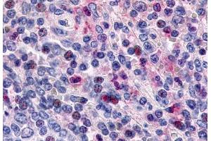 Anti-CCR1 antibody  ABIN1048385 IHC staining of human spleen, lymphocytes.