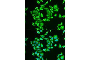 Immunofluorescence analysis of U2OS cells using PGM1 antibody (ABIN5973725).
