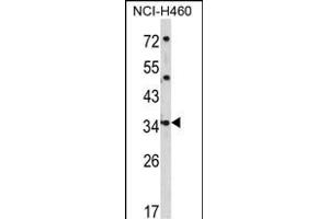 Western blot analysis of CER1 Antibody (N-term) (ABIN390938 and ABIN2841136) in NCI- cell line lysates (35 μg/lane). (CER1 Antikörper  (N-Term))