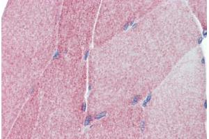 Human Skeletal Muscle (formalin-fixed, paraffin-embedded) stained with TEAD4 antibody ABIN462208 followed by biotinylated goat anti-rabbit IgG secondary antibody ABIN481713, alkaline phosphatase-streptavidin and chromogen. (TEAD4 Antikörper  (C-Term))