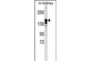 ABCC9 Antibody (Center) (ABIN1538549 and ABIN2849844) western blot analysis in mouse kidney tissue lysates (35 μg/lane).