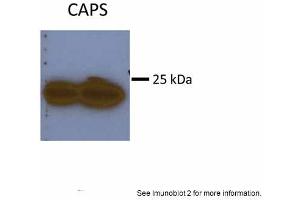 Sample Type: Huh7 HepG2 (50ug)Primary Antibody Dilution:1:500Image Submitted By: Partha KasturiUniversity of Kansas Medical Center (Calcyphosine Antikörper  (N-Term))
