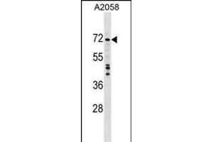 DDX56 Antibody (C-term) (ABIN1537431 and ABIN2848934) western blot analysis in  cell line lysates (35 μg/lane). (DDX56 Antikörper  (C-Term))