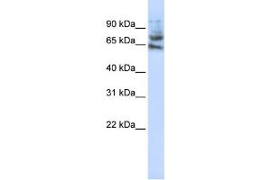 WB Suggested Anti-MCTP1 Antibody Titration:  1 ug/ml  Positive Control:  Jurkat cell lysate (MCTP1 Antikörper  (Middle Region))