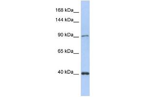 WB Suggested Anti-POLK Antibody Titration:  0.