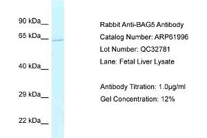 Western Blotting (WB) image for anti-BCL2-Associated Athanogene 5 (BAG5) (C-Term) antibody (ABIN2788981)