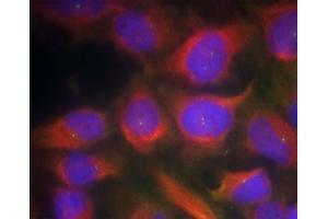 Immunofluorescence staining of methanol-fixed HeLa cells using NMDAR1 (Ab-897) Antibody (E021287, Red) (GRIN1/NMDAR1 Antikörper)