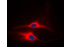 Immunofluorescent analysis of LCK staining in MCF7 cells. (LCK Antikörper  (Center))