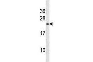 Trem2 antibody western blot analysis in mouse heart tissue lysate. (TREM2 Antikörper  (AA 22-48))