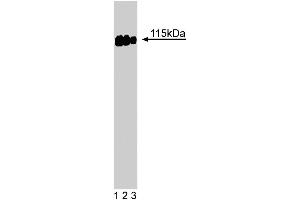 Western blot analysis of SRPK2 on a A431 cell lysate (Human epithelial carcinoma, ATCC CRL-1555). (SRPK2 Antikörper  (AA 363-485))