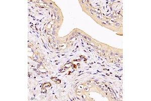 Immunohistochemistry (Paraffin-embedded Sections) (IHC (p)) image for anti-Myosin Light Chain 6, Alkali, Smooth Muscle and Non Muscle (MYL6) antibody (ABIN7074734)